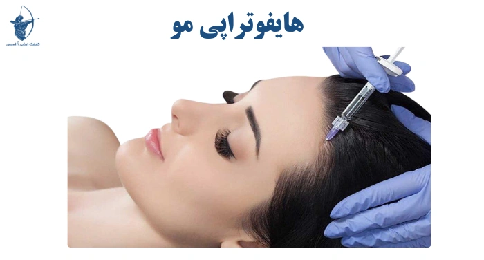هایفو مو