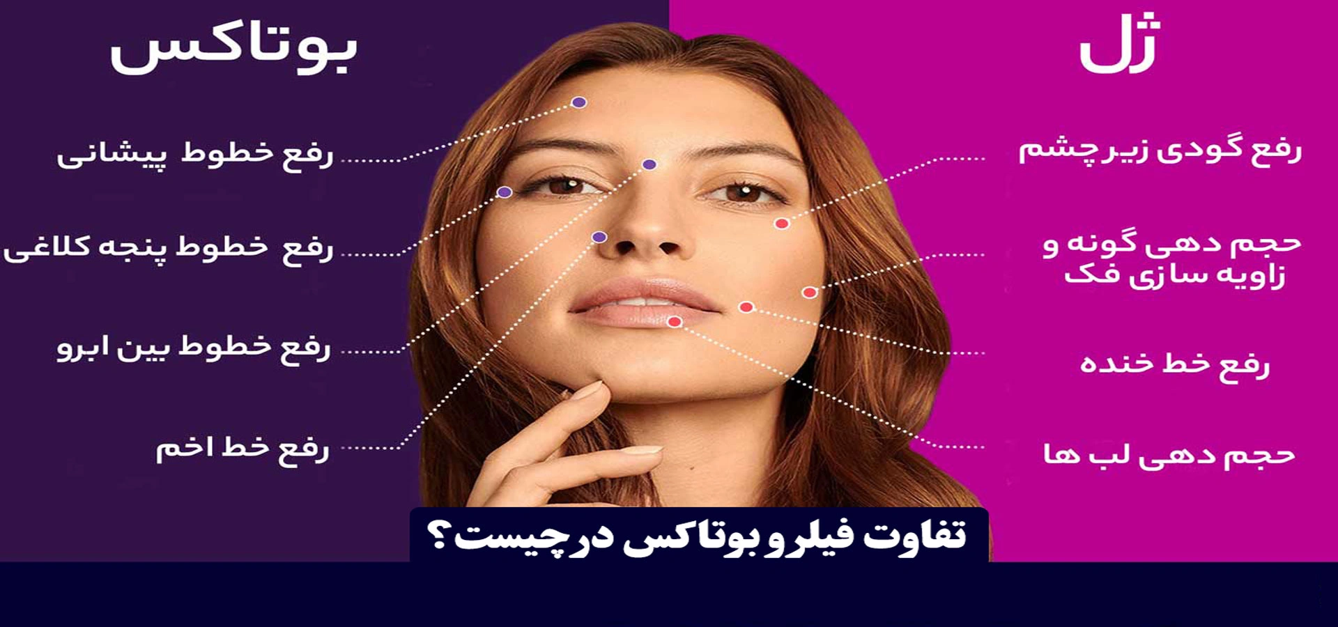 تفاوت فیلر و بوتاکس
